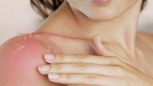 “Yayda sağlam insanların belə ehtiyatlı davranması vacibdir” – 