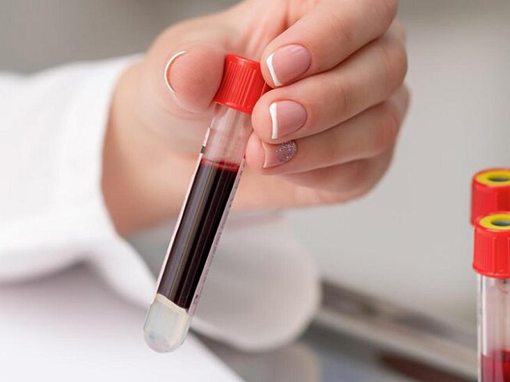 Blood group with a high risk of diabetes
