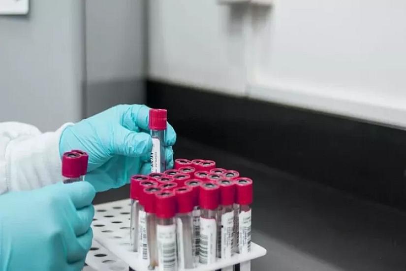 Qan testi ömrün uzunluğunu müəyyən 