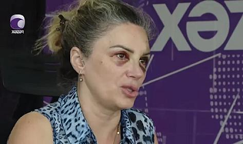Bakıda mağazada döyülən qadın danışdı - 