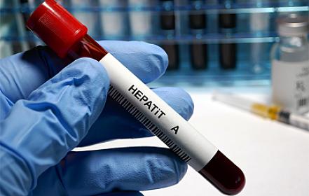 Azərbaycanda hepatitə yoluxanların sayı açıqlandı
