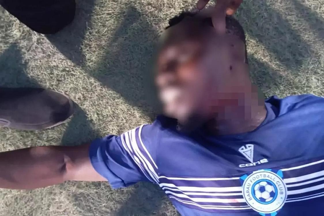 Azarkeşlər futbolçunun boğazını kəsdi - 