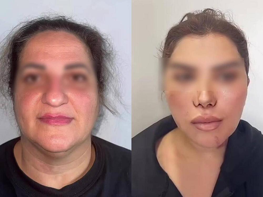 60 yaşlı qadını əməliyyatla bu hala saldılar - 