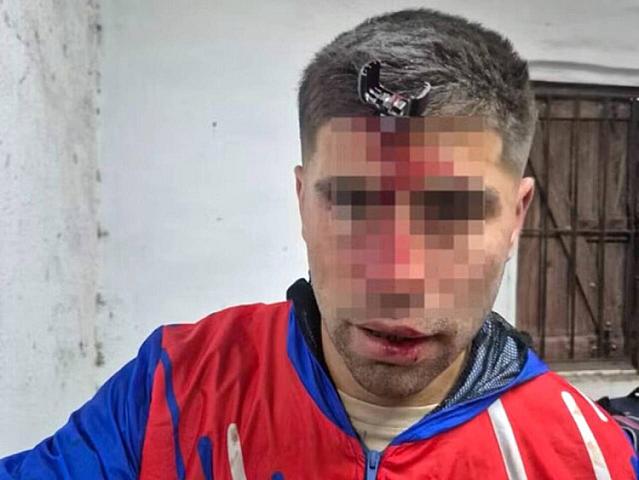 Açarla döydülər,