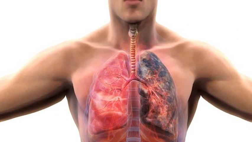 Siqaret çəkənlər üçün kritik 