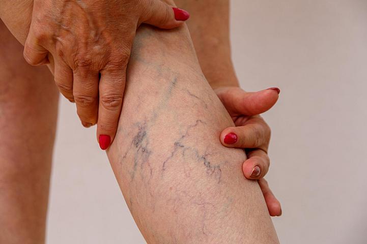 Tromboza səbəb olan 