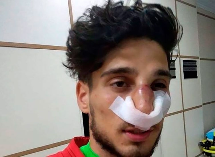 Mahir Mədətov qapıçının burnunu sındırdı - VİDEO