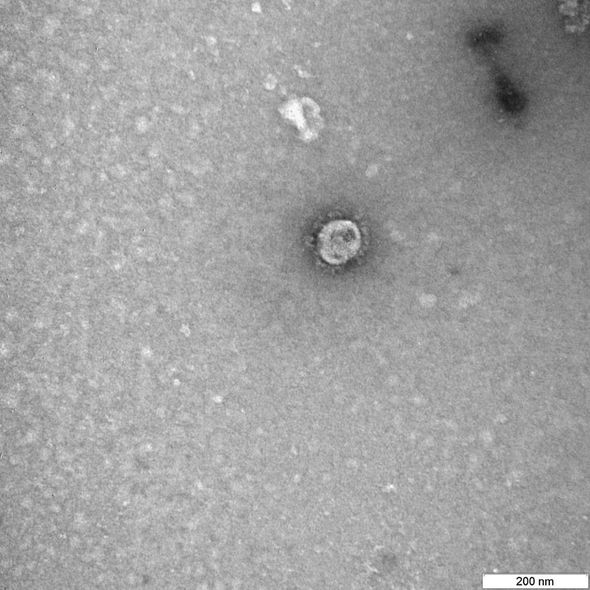 Koronavirusun ilk görüntüləri dərc olundu - FOTO