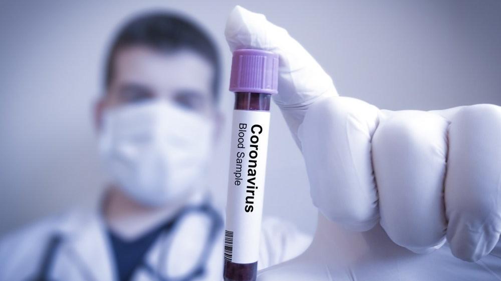 Koronavirus kişilərə, yoxsa qadınlara daha çox təsir edir? – ARAŞDIRMA