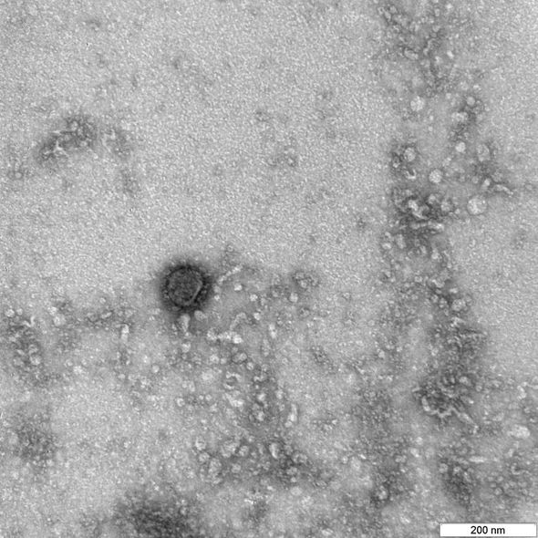 Koronavirusun ilk görüntüləri dərc olundu - FOTO